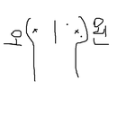 가슴에 난점 어떻게 생각하세요ㅠㅠ?
