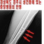 경상북도 경주시에있는 <b>중앙</b>병원의 만행