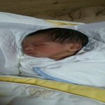 38<b>주유</b>도실패응급수술후기