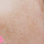 나의 얼굴피부 <b>시샘</b>하는 친구.