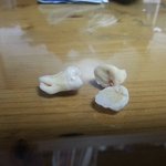 [도와주세요] 치과에서 이빨을 강제 <b>발치</b>당했는데 의사가 미친놈이라...