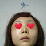 광대<b>축소</b>술가격 저렴하네요