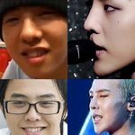 [빅뱅] 지디 <b>필러</b> 맞은거 나만 몰랐음?