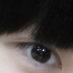 눈<b>다래끼</b> 짼 수술후기 (사진 ㅇ)