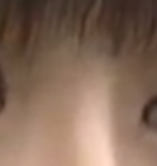 [댓글부탁] 사진ㅇ)코<b>수술</b>한건가요?