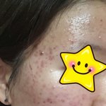 저보다 피부 안좋으신 여자분 계시나요..