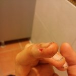 나오늘손다쳤어