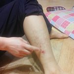[댓글부탁] 이상처 뭔지알려주세요