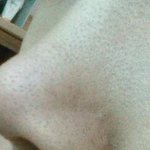 혐짤ㅇ)<b>블렉헤드</b>가너무심해요