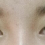 [<b>수술</b>고민중] 무쌍<b>눈</b>..어떤가요?