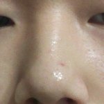 <b>코</b>많이낮나요...?ㅅㅂㅠㅠㅠ