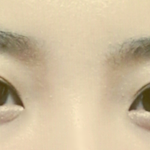 [알려주세요] 제 눈 좀 봐주세요... 수술한 것 같나요?