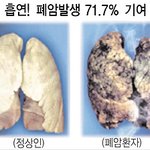 [어이없음] 담배소송 관련 진실이래요...