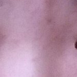 [봐주세요] 제눈은 앞트임 <b>뒷</b>트임 <b>밑</b>트임중 무엇을해야할까요?