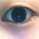 쌍커<b>풀이</b>없어서너무밋밋한데쌍수할까요?