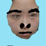 고민이에요 피부 <b>개선</b>법!