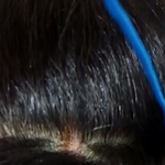 [댓글부탁] 매직후에 두피에서 <b>진물</b>이..(사진유)