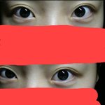 [알려주세요] <b>쌍</b>커풀(사진 <b>유</b>)