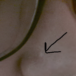 [알려주세요] <b>코옆</b>에2년째뭐가나있어요 알려주세요ㅜㅜ