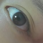 [댓글부탁] <b>쌍꺼풀</b>인가요??