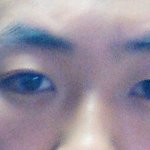 남자인데 <b>한쪽눈</b>만 쌍커풀이 생겼어요(사진o)