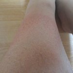 털많은여자보다 내다리가 갑임(혐오/사진유)