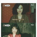 [EXO] 성형 <b>불법시술</b>은 하면안돼