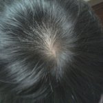 사진첨부)))남자...탈모인가요?? (아이돌 <b>우현</b> 영재 레오비교짤)