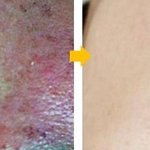썩었던 피부 <b>환생</b>담,,