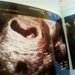 [댓글부탁] 아기<b>집</b><b>밑</b>에 까만<b>집</b>같은건뭔가요???