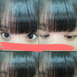 사진유)<b>쌍수</b>한눈같나요?