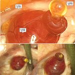 [공포베스트] 난자 배출 모습