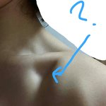[알려주세요] 사진ㅇ) 여잔데 쇄골 <b>아래</b> 이거뭐죠?