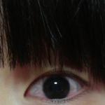 [EXO] ㅅㄷ. 이거<b>결막염</b>이냐 ㅠㅠ