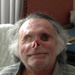 [공포베스트] 마이애미 <b>좀비</b>사건 피해자 회복사진