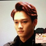 [EXO] 첸 쌍커풀 <b>수술</b>했냐?