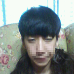 제눈 <b>안검</b>하수 하면 어떨까요??