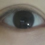 [꼭조언부탁] <b>쌍수</b>한거<b>티</b>많이나나여?ㅠ.ㅠ
