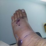 [공미니] [약혐] 위험한 <b>생물</b>들