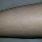 [댓글부탁] <b>사진</b>有/혐오주의)) 여고생인데 다리에 <b>털</b>이 너무많아요...