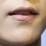 [EXO] 루한 입술 <b>흉터</b>