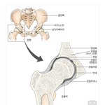 [댓글부탁] <b>골반</b>보고 고관절이라 헛소리하는 인간들 필독