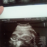 [꼭조언부탁] <b>양수</b>부족