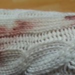 교통사고길고양이 구하려다 다쳤어요