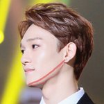 [EXO] 첸턱수술햇다는얘야