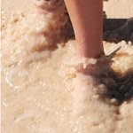 <미소진한의원> 허벅지 부종 관리법 간단히 <b>실천</b>해요