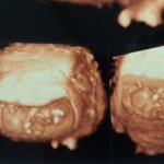 [답변부탁] 태아<b>성별</b>이궁금