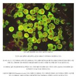 [<b>공포</b>베스트] 사람의 뇌를 파먹는 아메바