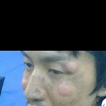 [짤북] 모기물린 <b>광수</b>ㅋㅋㅋㅋㅋㅋㅋㅋㅋㅋㅋㅋㅋㅋㅋㅋ