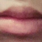 [댓글부탁] <b>입술</b>이 ㅠ